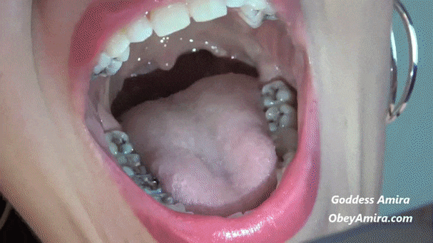 Japanese student uvula
