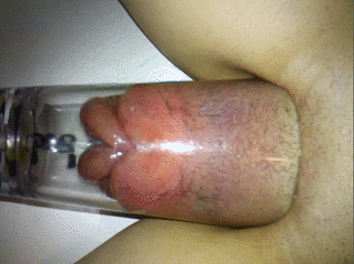 Sparkplug reccomend taking pussy pump after